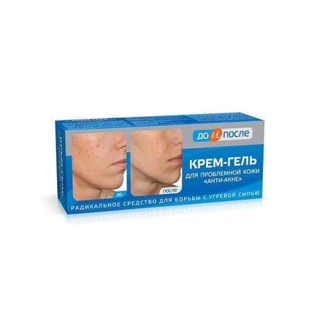 До и после крем-гель для лица Анти-акне для проблемнкожи 50мл 8106 251₽