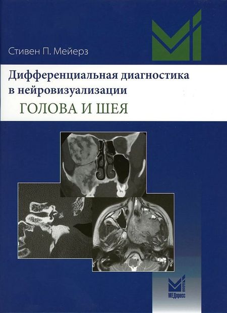 Стивен П. Мейерз Дифференциальная диагностика в нейровизуализации. Голова и шея