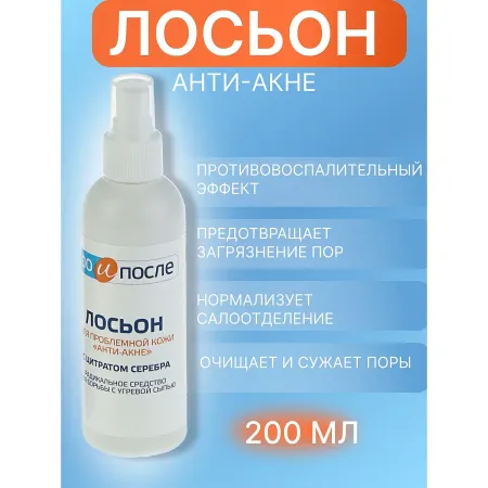 Лосьон
