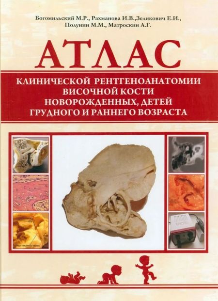 Михаил Рафаилович Богомильский, И. В. Рахманова, Е. И. Зеликович Атлас клинической рентгеноанатомии височной кости новорожденных, детей грудного и раннего возраста